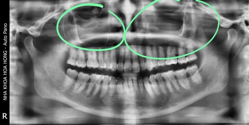 East Rose Dental xray